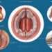 Can Hemorrhoids Cause Back Pain?